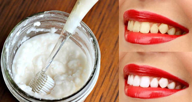 oubliez-le-dentiste-ces-3-astuces-simples-permettent-vous-blanchir-les-dents-a-la-maison